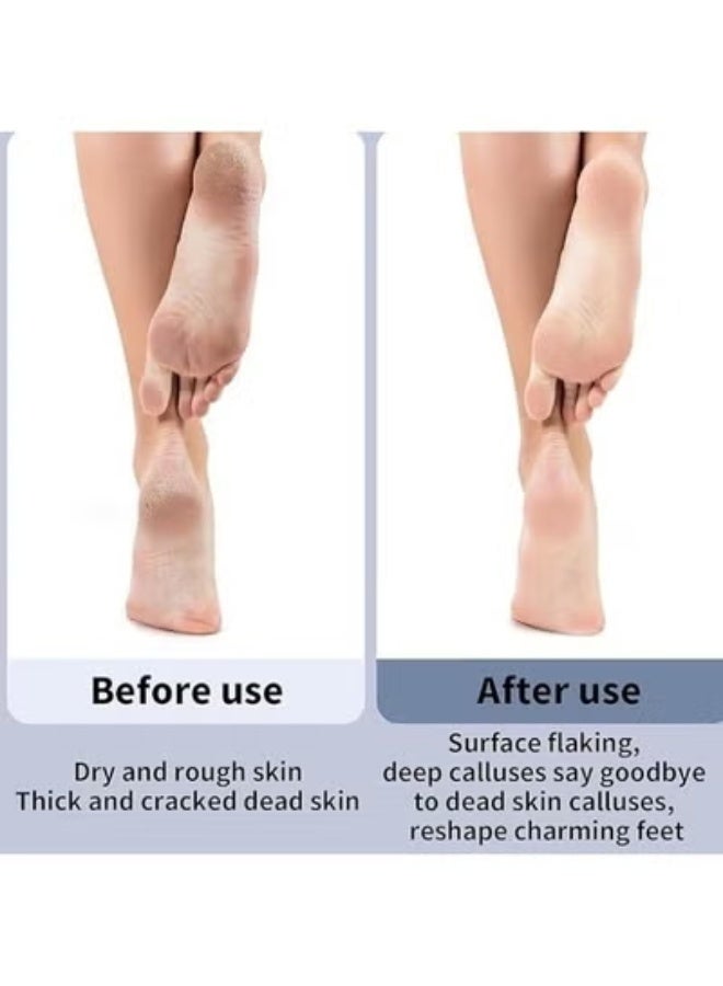 مبرد قدم كهربائي احترافي قابل لإعادة الشحن – جهاز إزالة الجلد الميت والكالوس وتشقق الكعبين – مبرد أقدام لاسلكي بـ 3 سرعات ورأسين صنفرة ناعم وخشن – عناية متكاملة بالقدمين من المنزل بنتائج فورية ونعومة فائقة – Electric Foot Grinder Professional Pedicure Tool - Image 4